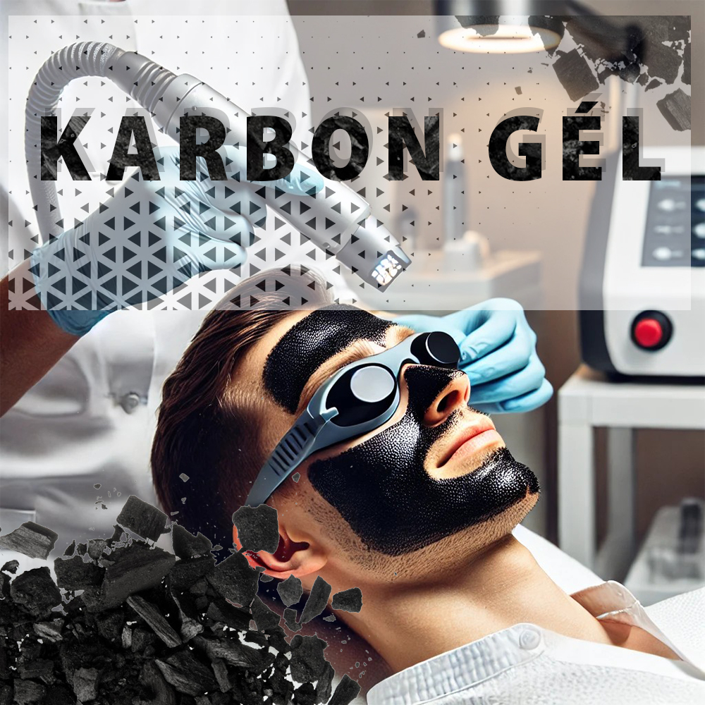 KARBON GÉL CARBON GEL HOLLYWOOD PEELING